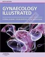 Gynaecology Illustrated