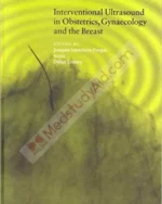Interventional Ultrasound in Obstetrics, Gynaecology and the Breast