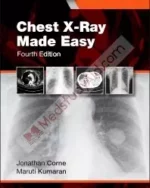 Chest X-Ray, Made Easy
