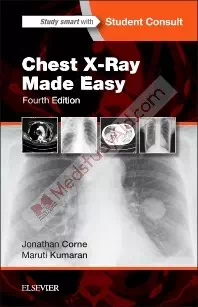 Chest X-Ray, Made Easy