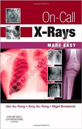 On Call X-Rays, Made Easy