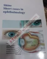 Shine Short Cases in Ophthalmology